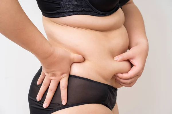 Overweight women belly black underwear — Stock Photo, Image