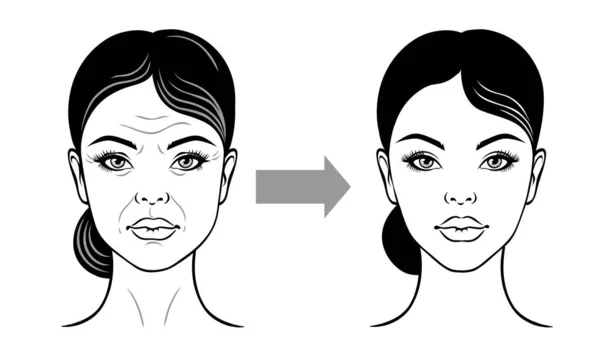 Twarz kobiety przed i po liftingu twarzy, przeciw starzeniu się. Ilustracja wektora na białym tle. — Wektor stockowy