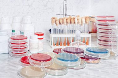 Petri kabında bakteri kolonisi olan bir masa.