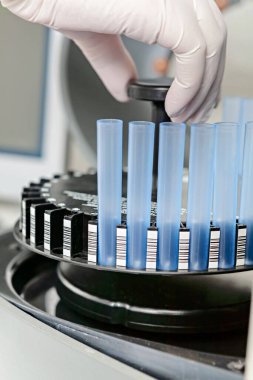 Laboratuvar aleti, el, kaseti kan analizi için santrifüje koyar.