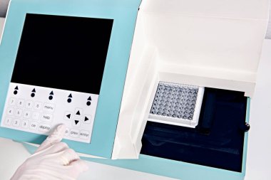 Kan testi analizörünün kontrol panelinde.