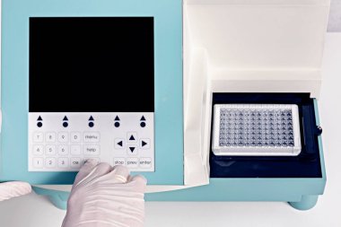 Kan testi analizörünün kontrol panelinde.