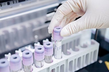 Tıbbi laboratuvar, test tüpü analizi.