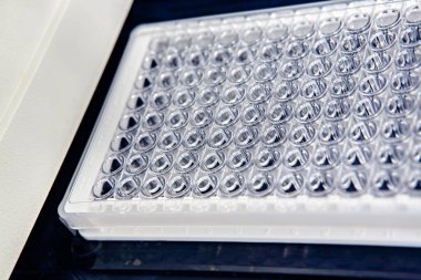 Örnek kaset kan analizine yüklendi