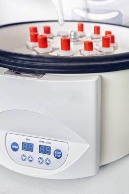 Kürtaj ekipmanları, kan analizi için santrifüj.