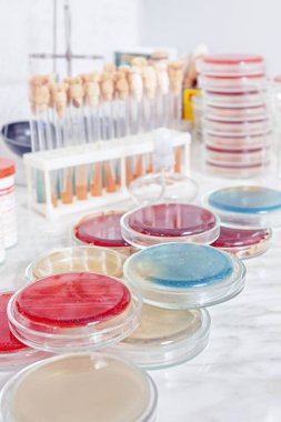 Petri kabında bakteri kolonisi olan bir masa.