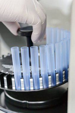 El, kaseti kan analizi için santrifüje koyar.