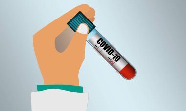 Çin haritasında Covid-19 virüsü için test tüpü pozitif.