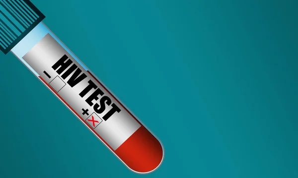 Тестовая трубка с образцом положительного вируса ВИЧ — стоковое фото
