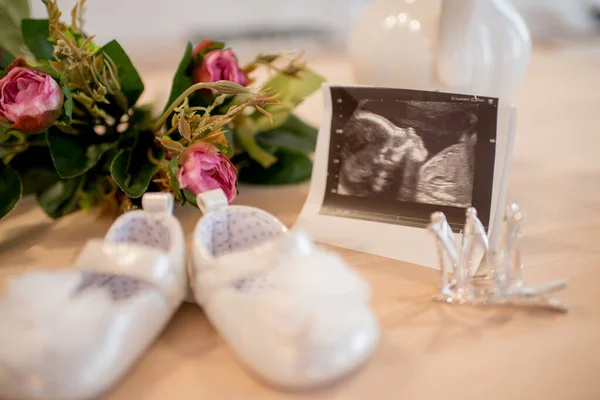 White Baby Booties Ultrasound Photo Baby Table — Stock Photo, Image