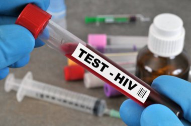 Yakın plan HIV kan testi.