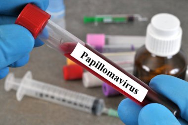 Papillomavirus analizine yakın kan tüpü.