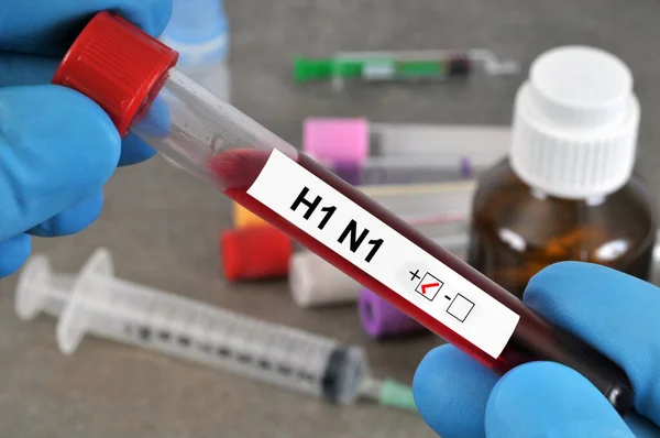 H1N1解析用血液チューブハンドクローズアップ — ストック写真