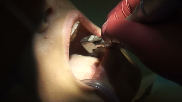 Menina trata os dentes do dentista — Vídeo de Stock