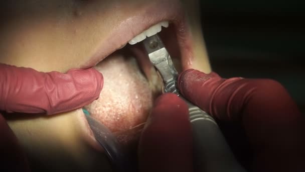 Γοητευτικό κορίτσι αντιμετωπίζει δοντιών από τον οδοντίατρο — Αρχείο Βίντεο