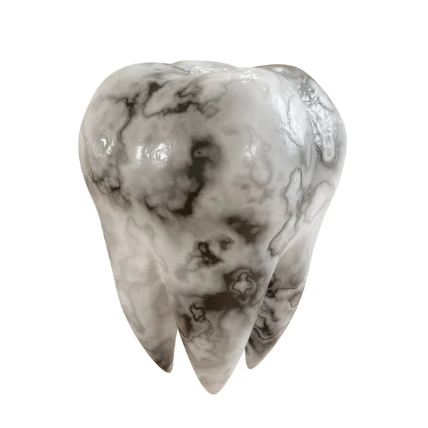 Cárie dente paciente em um fundo branco. Doença dentária. Ilustração 3D . — Fotografia de Stock