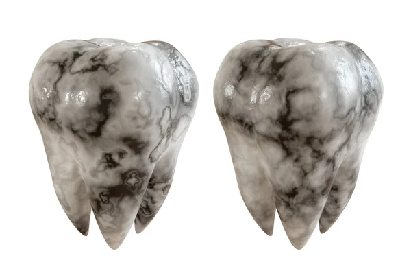 Caries diente paciente sobre fondo blanco. Enfermedad dental. Ilustración 3D . —  Fotos de Stock