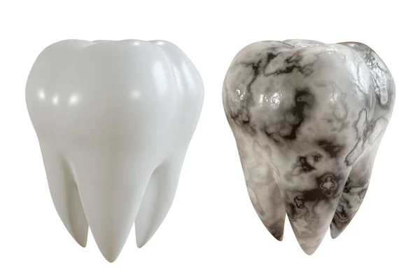 Imagen comparativa de un diente sano y un paciente con caries. Ilustración 3D . —  Fotos de Stock