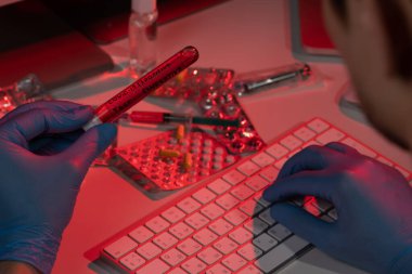 COVID-19 test koronavirüsü için kan örneği içeren tüp testi 