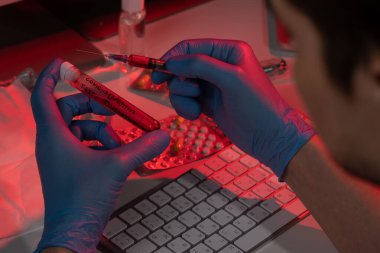 COVID-19 test koronavirüsü için kan örneği içeren tüp testi 