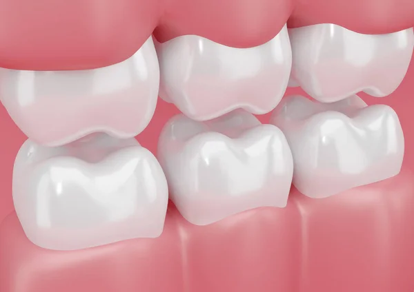 Closeup illustration of gums and teeth, 3D rendering