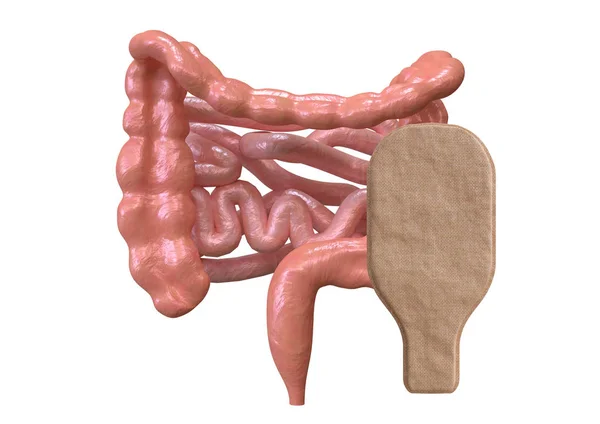 Bolsa de colostomía conectada con intestino aislado sobre fondo blanco — Foto de Stock