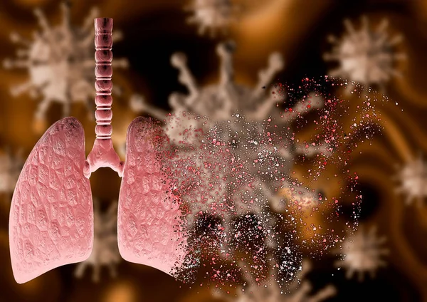 Coronavirus attacking lung with severe pneumonia disintegrating it, leading to death — 스톡 사진