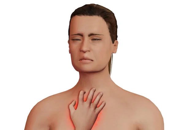 Reação alérgica da pele em um paciente. Mulher com comichão no peito e pode ser eczema, psoríase, dermatite . — Fotografia de Stock
