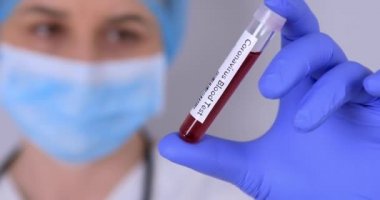 Hemşire pozitif Coronavirus kan örneğiyle test tüpü tutuyor. Virüs testi ve araştırma konsepti. Kan testi tüpüne odaklan. 4k