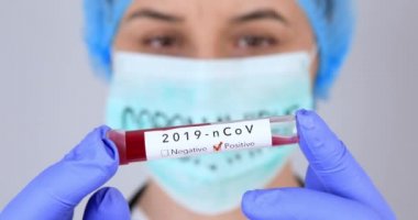 Hemşire pozitif Coronavirus kan örneğiyle test tüpü tutuyor. Virüs testi ve araştırma konsepti. Kan testi tüpüne odaklan. 4k