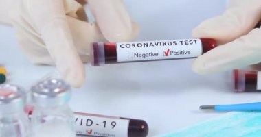 Analistlerin elinde COVID 19 Coronavirus kanı tutan koruyucu eldivenler var. Virüs testi ve araştırma konsepti. Dolly 4K 'yı vurdu.
