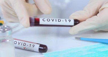 Analistlerin elinde COVID 19 Coronavirus kanı tutan koruyucu eldivenler var. Virüs testi ve araştırma konsepti. Dolly 4K 'yı vurdu.