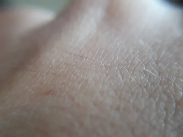 texture of the skin.Dark skin of woman hand macro. Human skin texture background