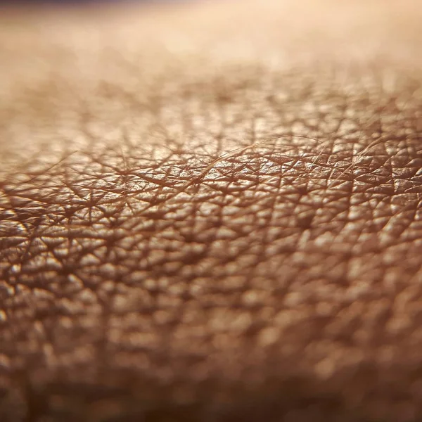 Melanoma Concept Closeup Macro Skin Human Hand Healthy Brown Skin — Stock Photo, Image