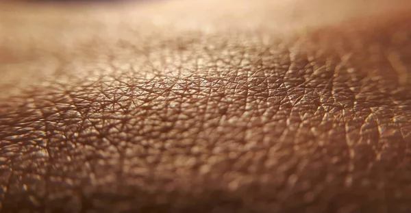 Conceito Doenças Pele Macro Pele Mão Humana Medicina Dermatologia Conceito — Fotografia de Stock