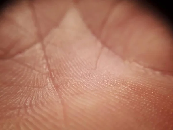 Macro Pele Mão Humana Medicina Dermatologia Conceito Detalhes Fundo Pele — Fotografia de Stock