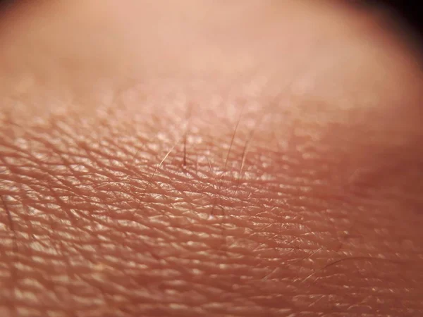 Human Skin Macro Photo Close — Stock Photo, Image