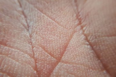 İnsan elinin makro derisi. Tıp ve dermatoloji kavramı. 