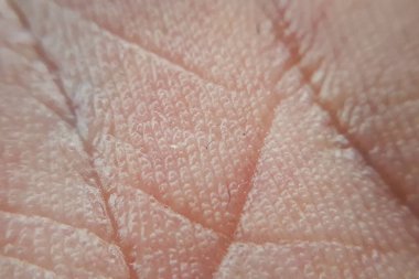 İnsan elinin makro derisi. Tıp ve dermatoloji kavramı. 