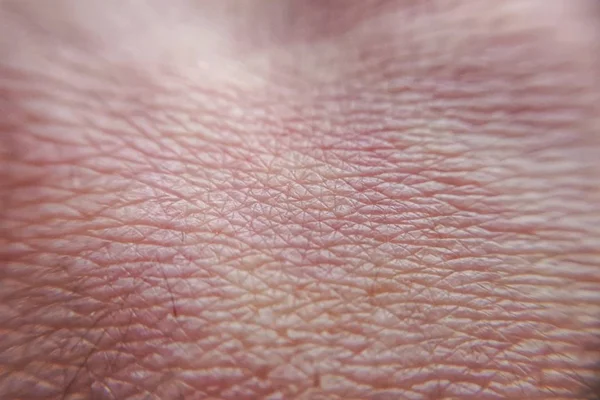 粉红健康人类皮肤的美感结构背景 — 图库照片