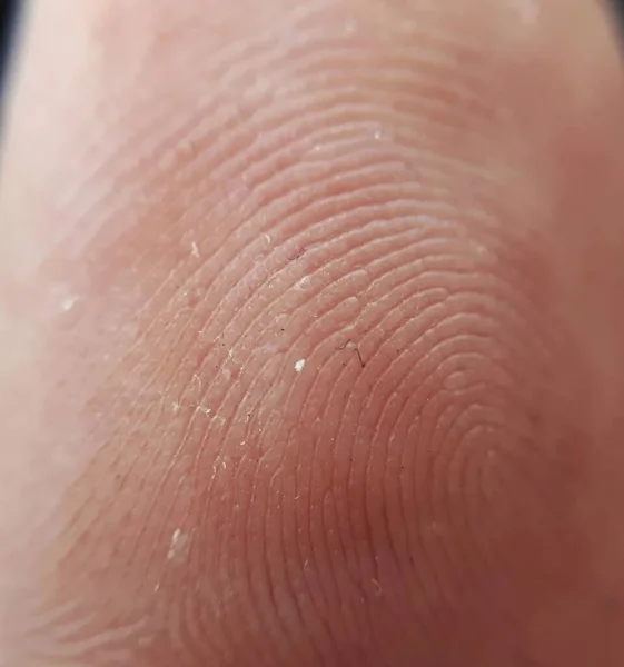 Κοντινό Πλάνο Της Υφής Δακτυλικών Αποτυπωμάτων Του Δέρματος Δάχτυλο Μακροεντολή — Φωτογραφία Αρχείου