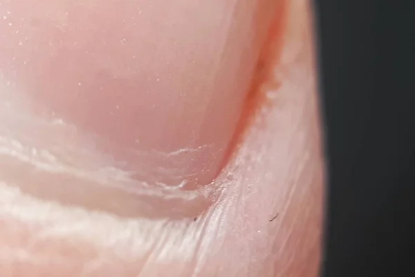 Nail Human Finger Close Macro — Stockfoto