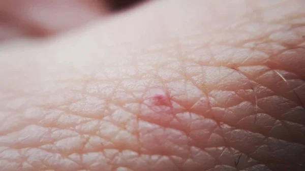 Makro Emberi Bőr Közelről Háttér Bőr Textúrája Orvosi Háttér — Stock Fotó