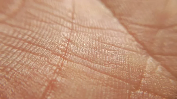 Detail of human skin hand. Macro dermatilis background.