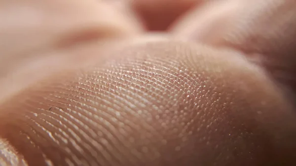 Szczegóły Ludzkiej Dłoni Skóry Tło Makrodermatozy — Zdjęcie stockowe