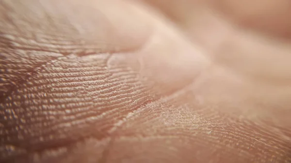 Mão Fechada Macro Shin Mão Textura Para Dermatologia Fundo — Fotografia de Stock