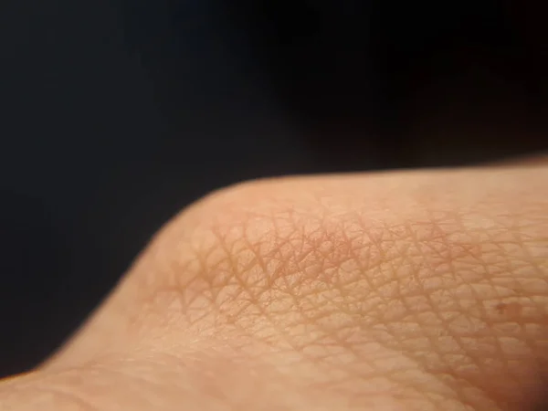 Dermatology background with human hand skin.