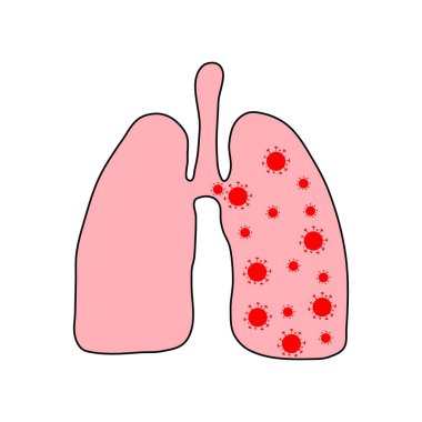 Ciğerlerinde kovid 19 koronavirüs var. Virüs Akciğerde. Enfeksiyon kapmış akciğerler. Coronavirus, Covid-19. 2019-Ncov. Lung Diseas