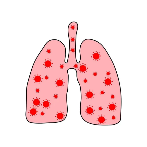 Sick Lungs Covid Coronavirus Virus Cells Lung Infected Lungs Coronavirus — Stock Vector