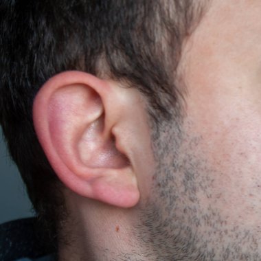 Kulak kompleksi. İnsan kulakları kocaman. Genç Kafkas Erkek Kulak Kapanışı.